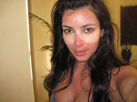 kim-kardashian-sunburn -1